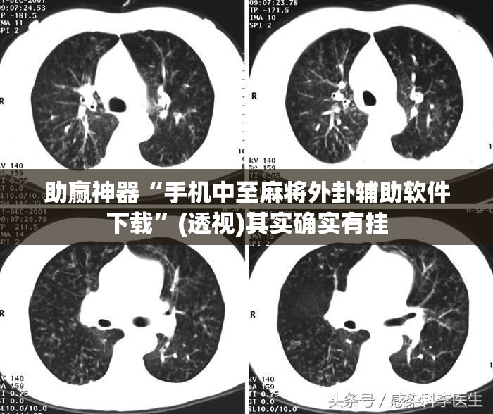 助赢神器“手机中至麻将外卦辅助软件下载”(透视)其实确实有挂